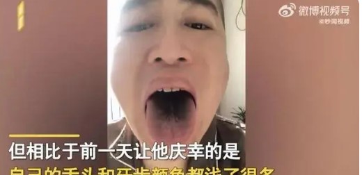 男子确诊后舌头牙齿全变黑